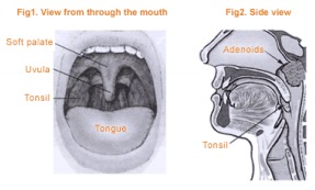 tonsils and adenoids